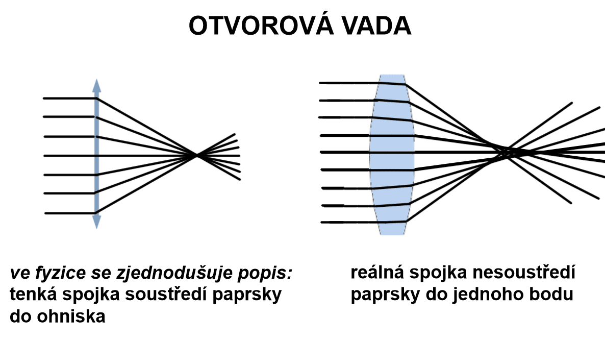 Otvorová vada